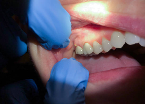  St Clair, PA Emergency Dentist Pros